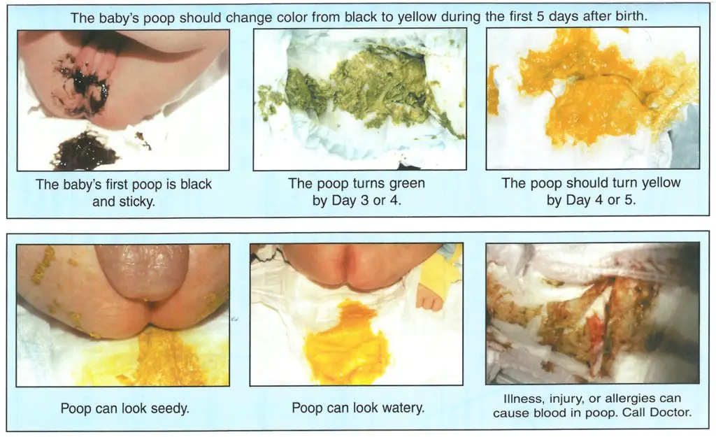 types of baby poops and what is normal